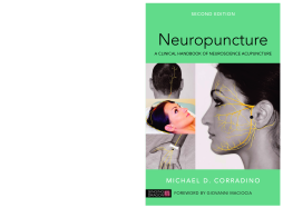 Neuropuncture Neuropuncture