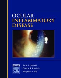 E-Book - Ocular Inflammatory Disease