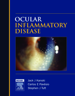 E-Book - Ocular Inflammatory Disease E-Book - Ocular Inflammatory Disease