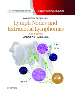 Diagnostic Pathology: Lymph Nodes and Extranodal Lymphomas E-Book Diagnostic Pathology: Lymph Nodes and Extranodal Lymphomas E-Book