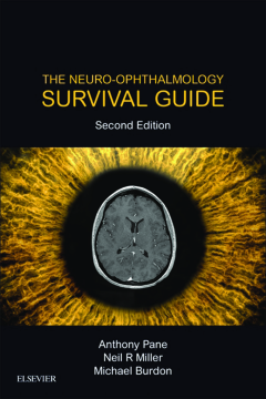 The Neuro-Ophthalmology Survival Guide E-Book The Neuro-Ophthalmology Survival Guide E-Book
