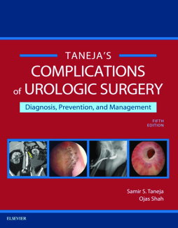 Complications of Urologic Surgery E-Book Complications of Urologic Surgery E-Book
