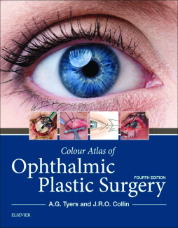 Colour Atlas of Ophthalmic Plastic Surgery E-Book Colour Atlas of Ophthalmic Plastic Surgery E-Book