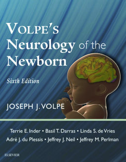 Volpe's Neurology of the Newborn E-Book Volpe's Neurology of the Newborn E-Book