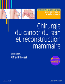 Chirurgie du cancer du sein et reconstruction mammaire Chirurgie du cancer du sein et reconstruction mammaire