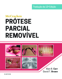 McCracken Prótese Parcial Removível McCracken Prótese Parcial Removível