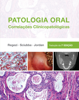 Patologia Oral Patologia Oral