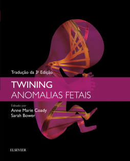 Twining Anomalias Fetais Twining Anomalias Fetais