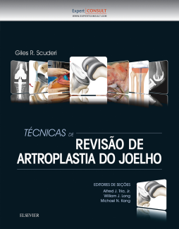 Técnicas de Revisão de Artroplastia do Joelho Técnicas de Revisão de Artroplastia do Joelho