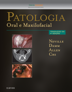 Patologia Oral e Maxilofacial Patologia Oral e Maxilofacial