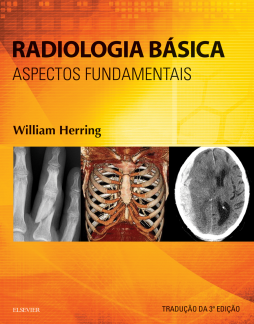 Radiologia Básica Radiologia Básica