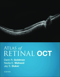 Atlas of Retinal OCT E-Book Atlas of Retinal OCT E-Book