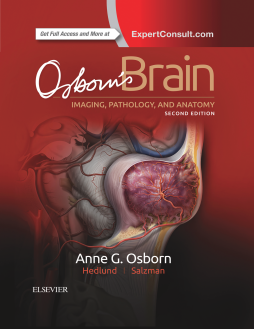 Osborn's Brain E-Book Osborn's Brain E-Book