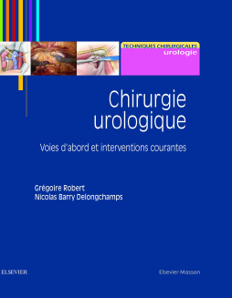 Chirurgie urologique Chirurgie urologique