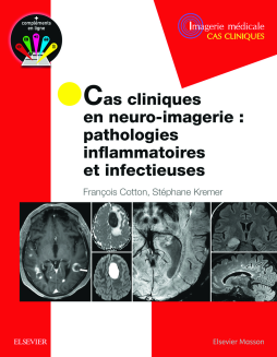 Cas cliniques en neuro-imagerie : pathologies inflammatoires et infectieuses Cas cliniques en neuro-imagerie : pathologies inflammatoires et infectieuses