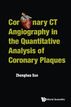 Coronary Ct Angiography In The Quantitative Analysis Of Coronary Plaques Coronary Ct Angiography In The Quantitative Analysis Of Coronary Plaques