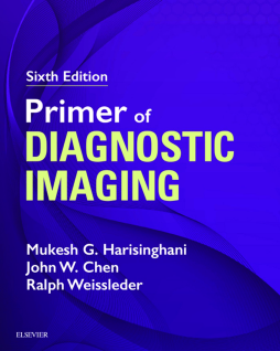 Primer of Diagnostic Imaging E-Book Primer of Diagnostic Imaging E-Book