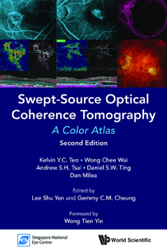 Swept-source Optical Coherence Tomography: A Color Atlas (Second Edition)
