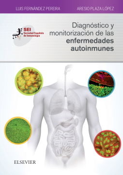 Diagnóstico y monitorización de las enfermedades autoinmunes Diagnóstico y monitorización de las enfermedades autoinmunes