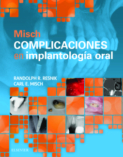Misch. Complicaciones en implantología oral Misch. Complicaciones en implantología oral