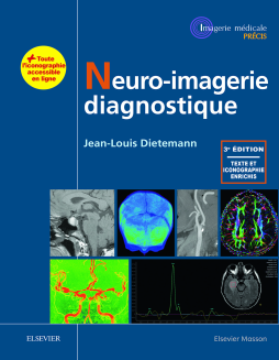 Neuro-imagerie diagnostique Neuro-imagerie diagnostique