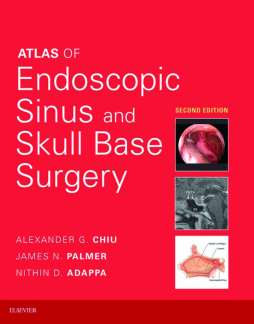 Atlas of Endoscopic Sinus and Skull Base Surgery E-Book Atlas of Endoscopic Sinus and Skull Base Surgery E-Book