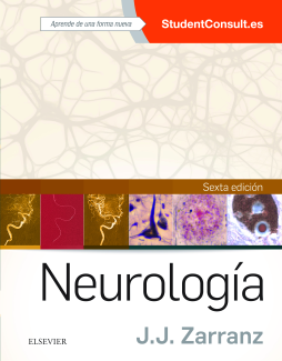 Neurología Neurología