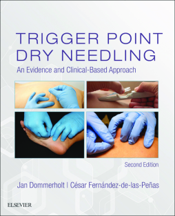 Trigger Point Dry Needling E-Book Trigger Point Dry Needling E-Book
