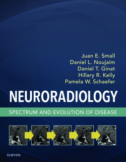 Neuroradiology Neuroradiology