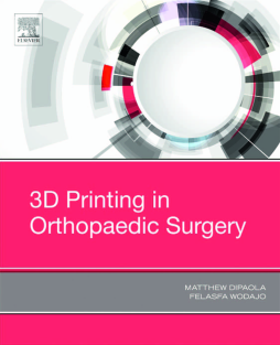 3D Printing in Orthopaedic Surgery 3D Printing in Orthopaedic Surgery