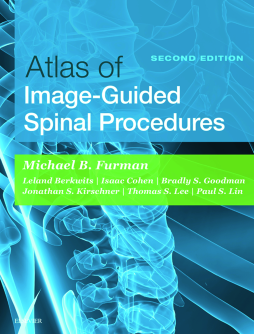 Atlas of Image-Guided Spinal Procedures E-Book Atlas of Image-Guided Spinal Procedures E-Book