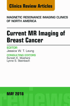 Current MR Imaging of Breast Cancer, An Issue of Magnetic Resonance Imaging Clinics of North America, E-Book Current MR Imaging of Breast Cancer, An Issue of Magnetic Resonance Imaging Clinics of North America, E-Book