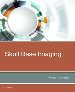 Skull Base Imaging Skull Base Imaging