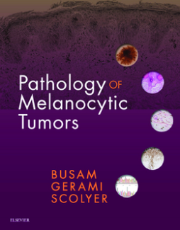 Pathology of Melanocytic Tumors E-Book