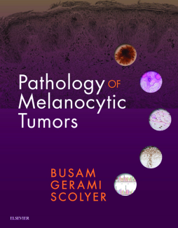 Pathology of Melanocytic Tumors E-Book Pathology of Melanocytic Tumors E-Book