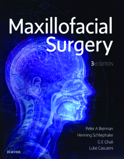 Maxillofacial Surgery - E-Book Maxillofacial Surgery - E-Book
