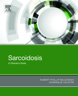 Sarcoidosis Sarcoidosis