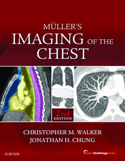 Muller's Imaging of the Chest E-Book