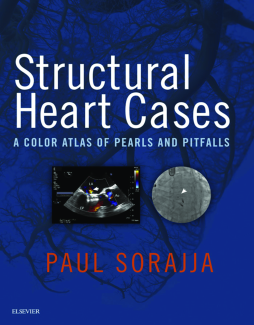 Structural Heart Cases E-Book Structural Heart Cases E-Book