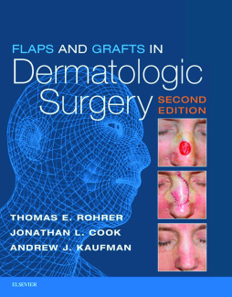 Flaps and Grafts in Dermatologic Surgery E-Book Flaps and Grafts in Dermatologic Surgery E-Book