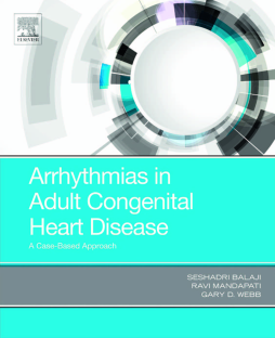 Arrhythmias in Adult Congenital Heart Disease Arrhythmias in Adult Congenital Heart Disease