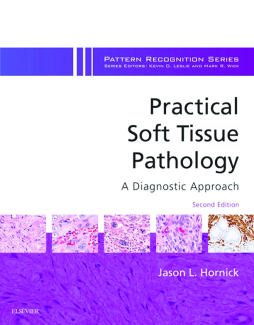 Practical Soft Tissue Pathology: A Diagnostic Approach E-Book Practical Soft Tissue Pathology: A Diagnostic Approach E-Book
