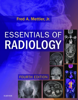 Essentials of Radiology E-Book
