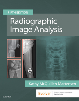 Radiographic Image Analysis E-Book Radiographic Image Analysis E-Book