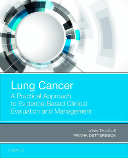 Lung Cancer: A Practical Approach to Evidence-Based Clinical Evaluation and Management Lung Cancer: A Practical Approach to Evidence-Based Clinical Evaluation and Management