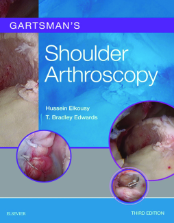 Gartsman's Shoulder Arthroscopy E-Book
