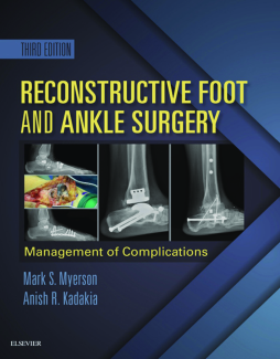 Reconstructive Foot and Ankle Surgery: Management of Complications E-Book Reconstructive Foot and Ankle Surgery: Management of Complications E-Book