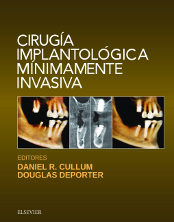 Cirugía implantológica mínimamente invasiva Cirugía implantológica mínimamente invasiva