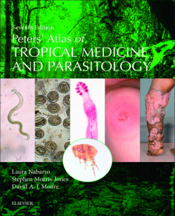 Peters' Atlas of Tropical Medicine and Parasitology E-Book