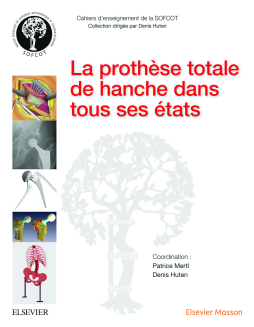 La prothèse totale de hanche dans tous ses états La prothèse totale de hanche dans tous ses états